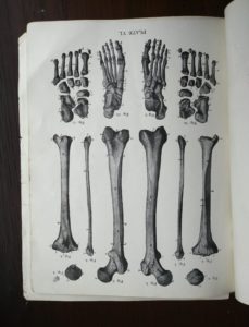 image inside a Vintage Anatomy Atlas of the Human Body Modern Medicine Publishing Company