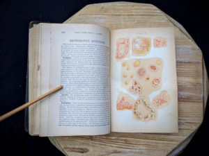 erythematous affections illustraion - 1895 The Peoples Common Sense Medical Adviser by R.V. Pierce M.D.