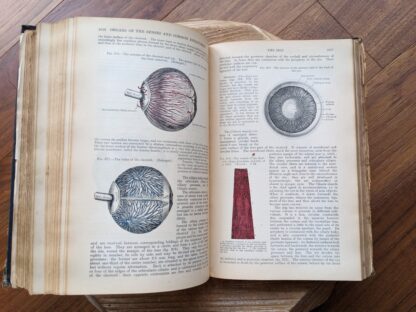 the iris - 1926 Gray's Anatomy - Descriptive and Applied - 23rd Edition - Longmans, Green and Co. Ltd.