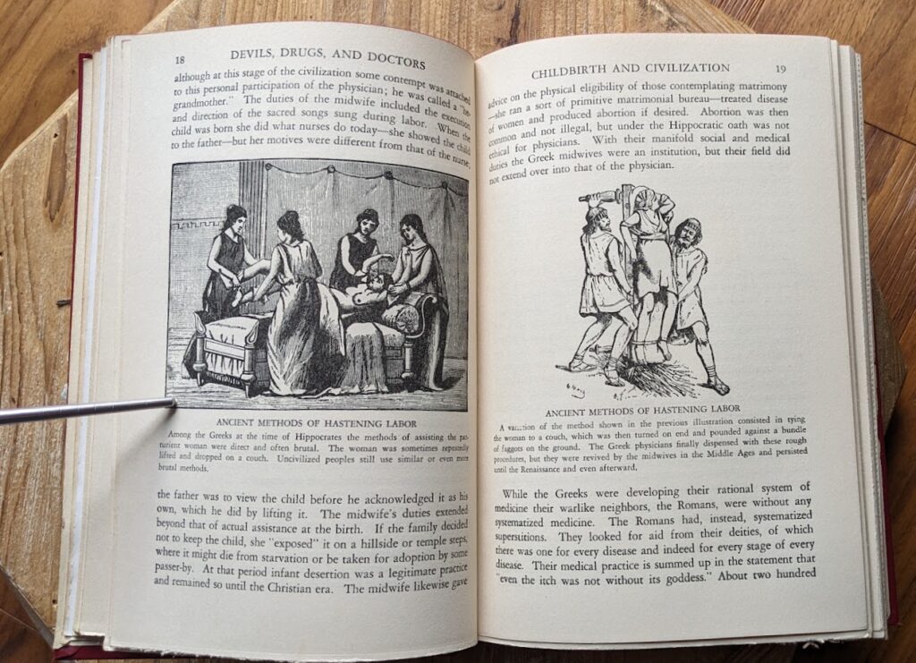 1929 Devils Drugs and Doctors by Howard W Haggard - Ancient Methods of Hastening Labor